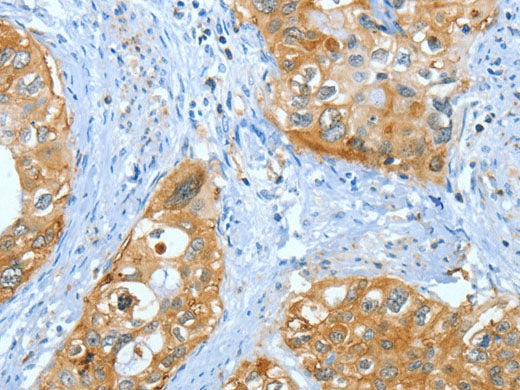 ANXA3 Polyclonal Antibody Store at -20°C