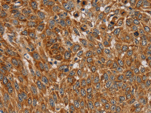 PLEKHG6 Polyclonal Antibody Store at -20°C
