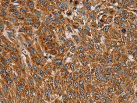 PLEKHG6 Polyclonal Antibody Store at -20°C
