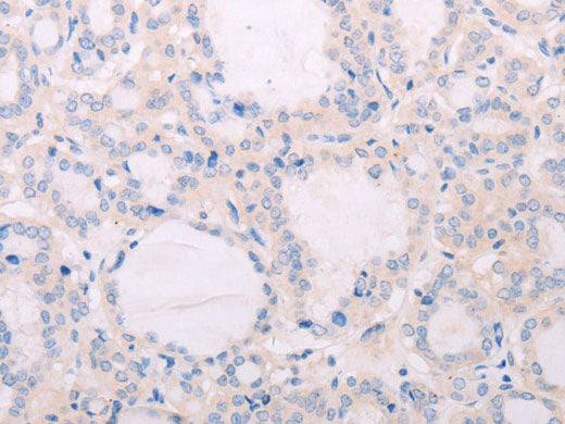 TSHR Polyclonal Antibody Store at -20°C