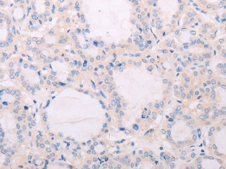 TSHR Polyclonal Antibody Store at -20°C