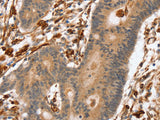 SSX2IP Polyclonal Antibody Store at -20°C