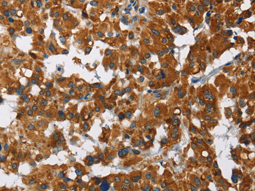 CAT Polyclonal Antibody Store at -20°C