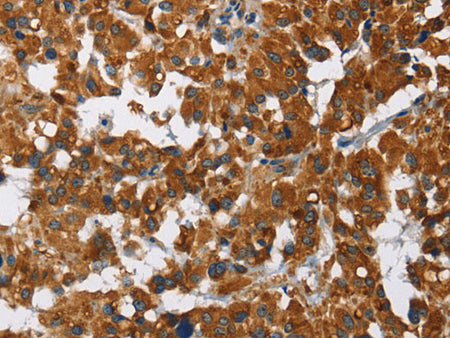 CAT Polyclonal Antibody Store at -20°C