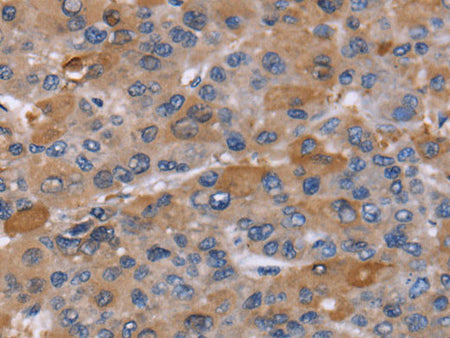NCF2 Polyclonal Antibody