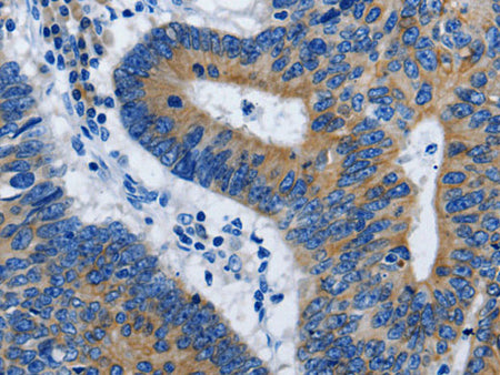 BPIFB3 Polyclonal Antibody Store at -20°C