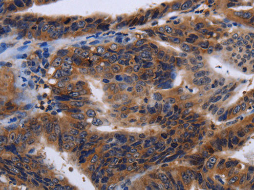 HTR2B Polyclonal Antibody Store at -20°C
