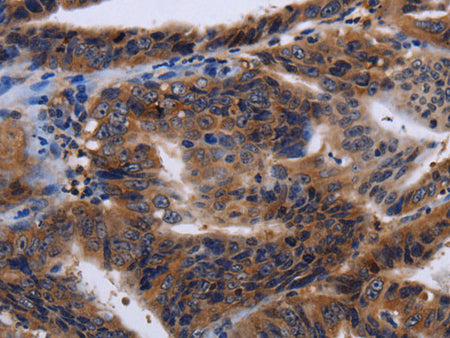 HTR2B Polyclonal Antibody Store at -20°C