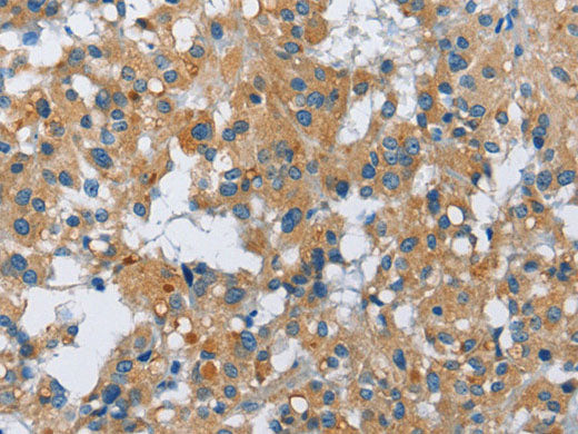 FGF9 Polyclonal Antibody Store at -20°C