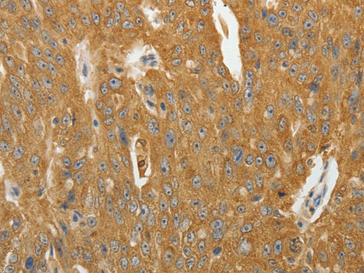 AKR1B1 Polyclonal Antibody Store at -20°C