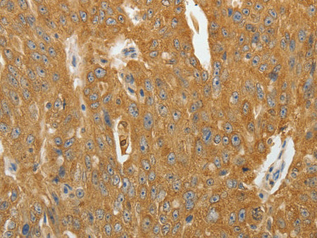AKR1B1 Polyclonal Antibody Store at -20°C