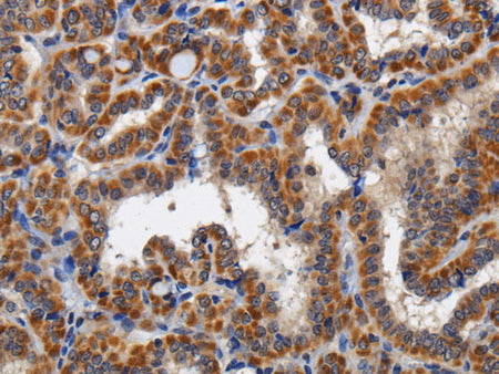 KLK6 Polyclonal Antibody Store at -20°C