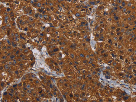 HYAL2 Polyclonal Antibody Store at -20°C