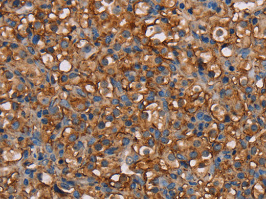 NEDD4L Polyclonal Antibody Store at -20°C