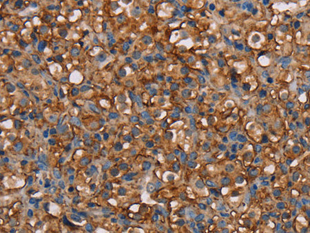 NEDD4L Polyclonal Antibody Store at -20°C