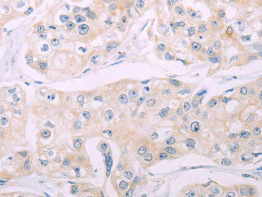ADCY7 Polyclonal Antibody