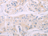 ADCY7 Polyclonal Antibody