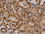hnRNP G Polyclonal Antibody