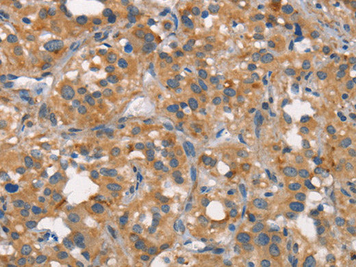 CEACAM6 Polyclonal Antibody Store at -20°C