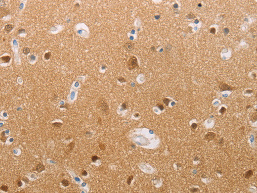 PFN2 Polyclonal Antibody