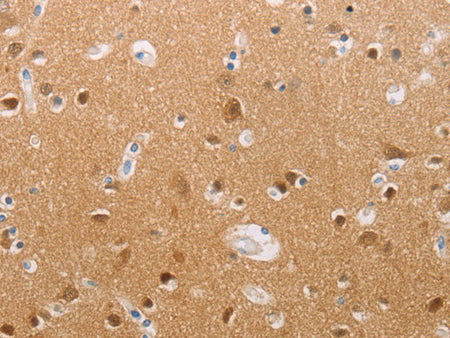 PFN2 Polyclonal Antibody