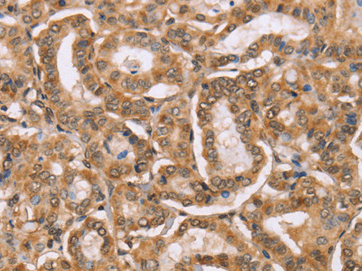 BGLAP Polyclonal Antibody Reactivity Human