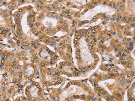 BGLAP Polyclonal Antibody Reactivity Human