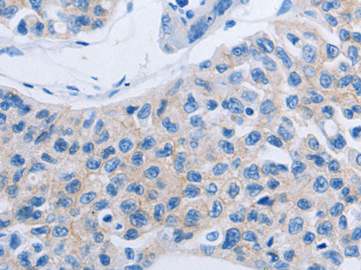 HOXA6 Polyclonal Antibody Store at -20°C