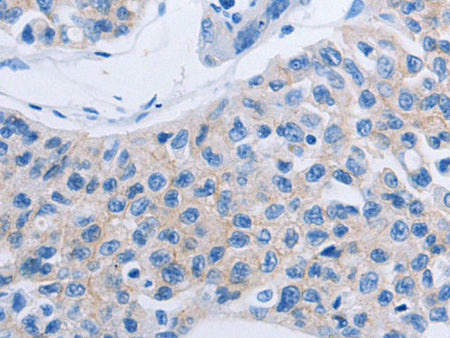 HOXA6 Polyclonal Antibody Store at -20°C