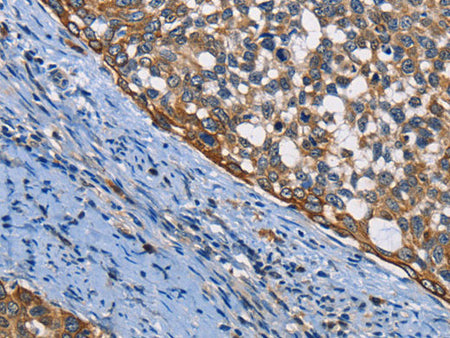 PGK1 Polyclonal Antibody Store at -20°C