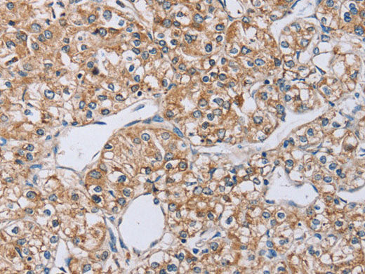 EDA Polyclonal Antibody Store at -20°C