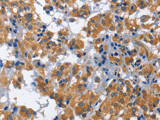 HSF27 Polyclonal Antibody Store at -20°C