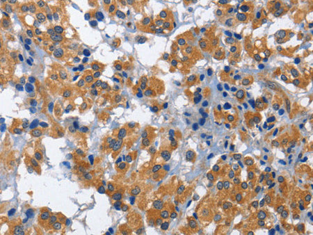 HSF27 Polyclonal Antibody Store at -20°C
