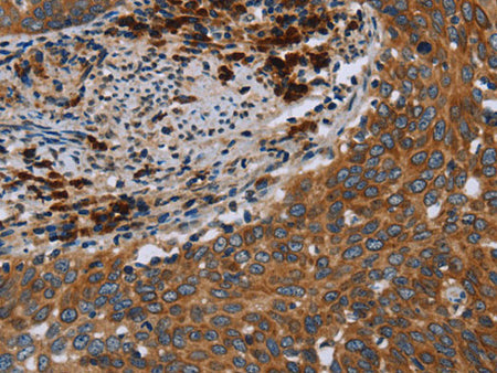HYAL3 Polyclonal Antibody Store at -20°C