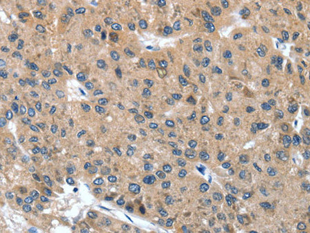 DSC1 Polyclonal Antibody Store at -20°C