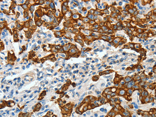 CK-18 Polyclonal Antibody Store at -20°C