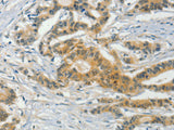 ASB8 Polyclonal Antibody