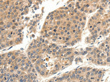 SLC27A1 Polyclonal Antibody Store at -20°C