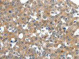 SCN11A Polyclonal Antibody Store at -20°C