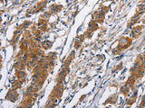 NCAPD3 Polyclonal Antibody