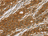 CYP27A1 Polyclonal Antibody