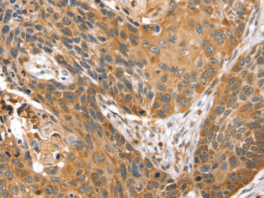 STX10 Polyclonal Antibody Store at -20°C
