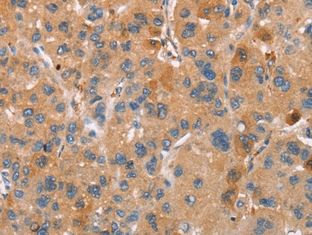 PLIN2 Polyclonal Antibody Store at -20°C