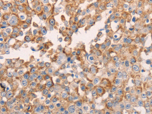 GNA11 Polyclonal Antibody Store at -20°C