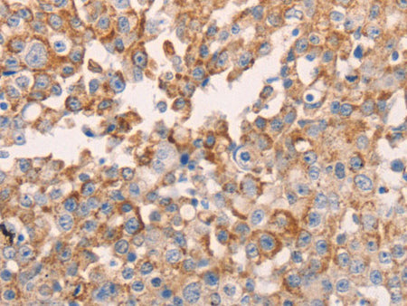 GNA11 Polyclonal Antibody Store at -20°C