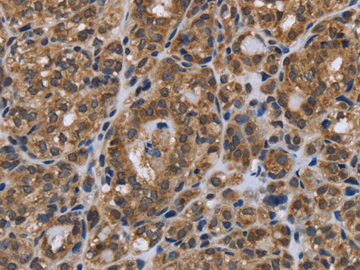 GALK1 Polyclonal Antibody