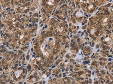 GALK1 Polyclonal Antibody