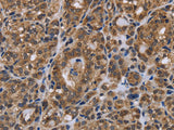 GALK1 Polyclonal Antibody