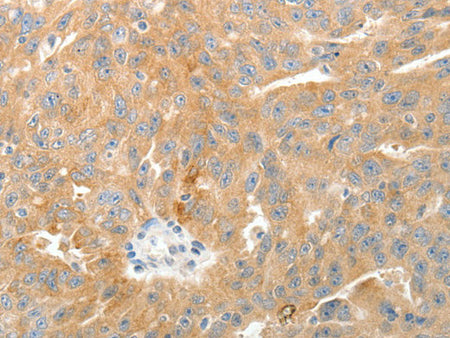 TEP1 Polyclonal Antibody Store at -20°C