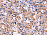 MMP14 Polyclonal Antibody Store at -20°C